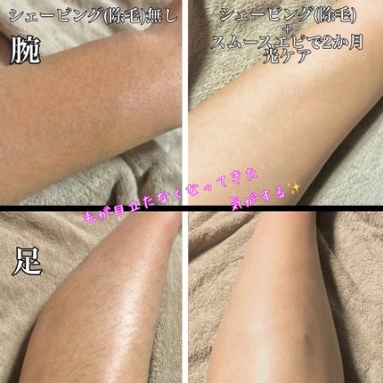 光エステ スムースエピ ES-WG0A/Panasonic/家庭用脱毛器を使ったクチコミ(6枚目)