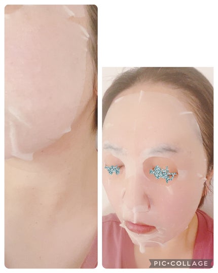 VCãã£ãŒãž ã¹ã ãŒã¹ãã¹ã¯/PERFECT ONE FOCUS/ã·ãŒããã¹ã¯ã»ããã¯ã䜿ã£ãã¯ãã³ãïŒ5æç®ïŒ