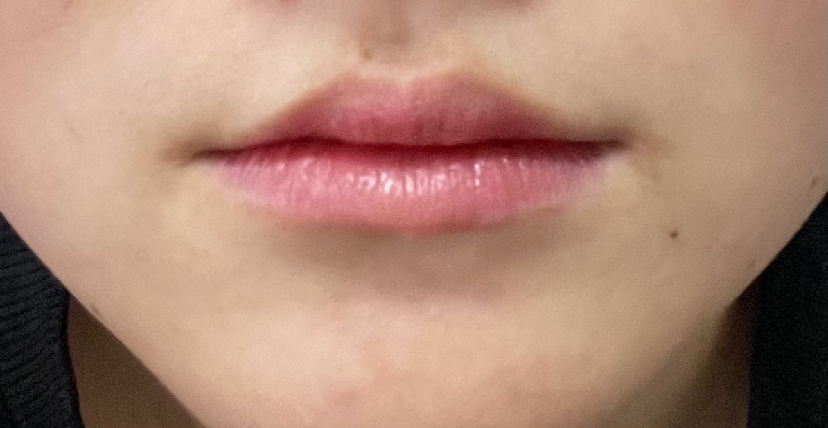 ジューシーリッププランパー6g/TPSY/リッププランパーを使ったクチコミ（3枚目）