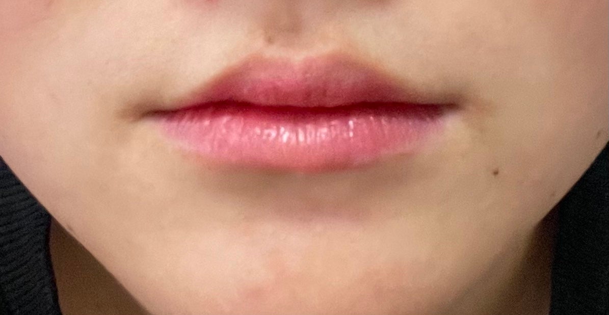 ジューシーリッププランパー6g/TPSY/リッププランパーを使ったクチコミ(3枚目)