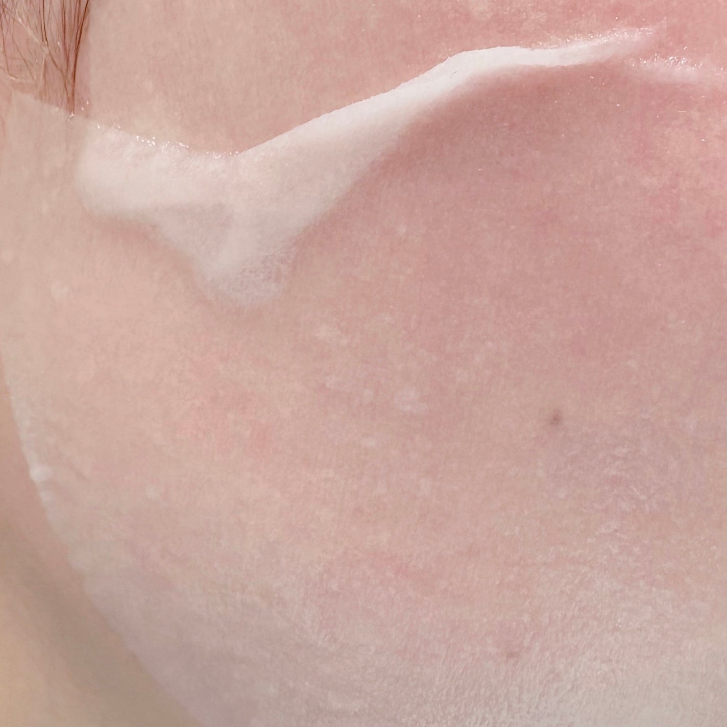 ティーツリー エッセンシャルマスクカーミングモイスチャー/MEDIHEAL/シートマスク・パックを使ったクチコミ(3枚目)