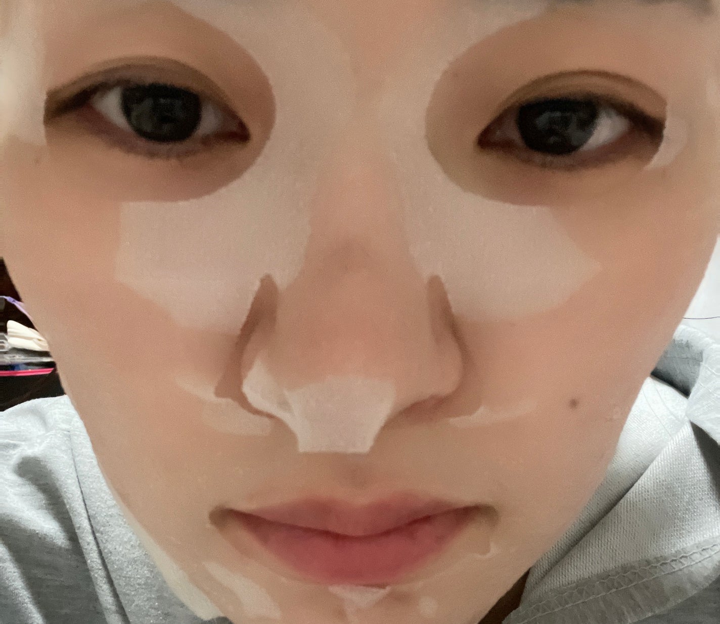 ダーマレーザー スーパーレチノール100マスク/クオリティファースト/シートマスク・パックを使ったクチコミ(2枚目)