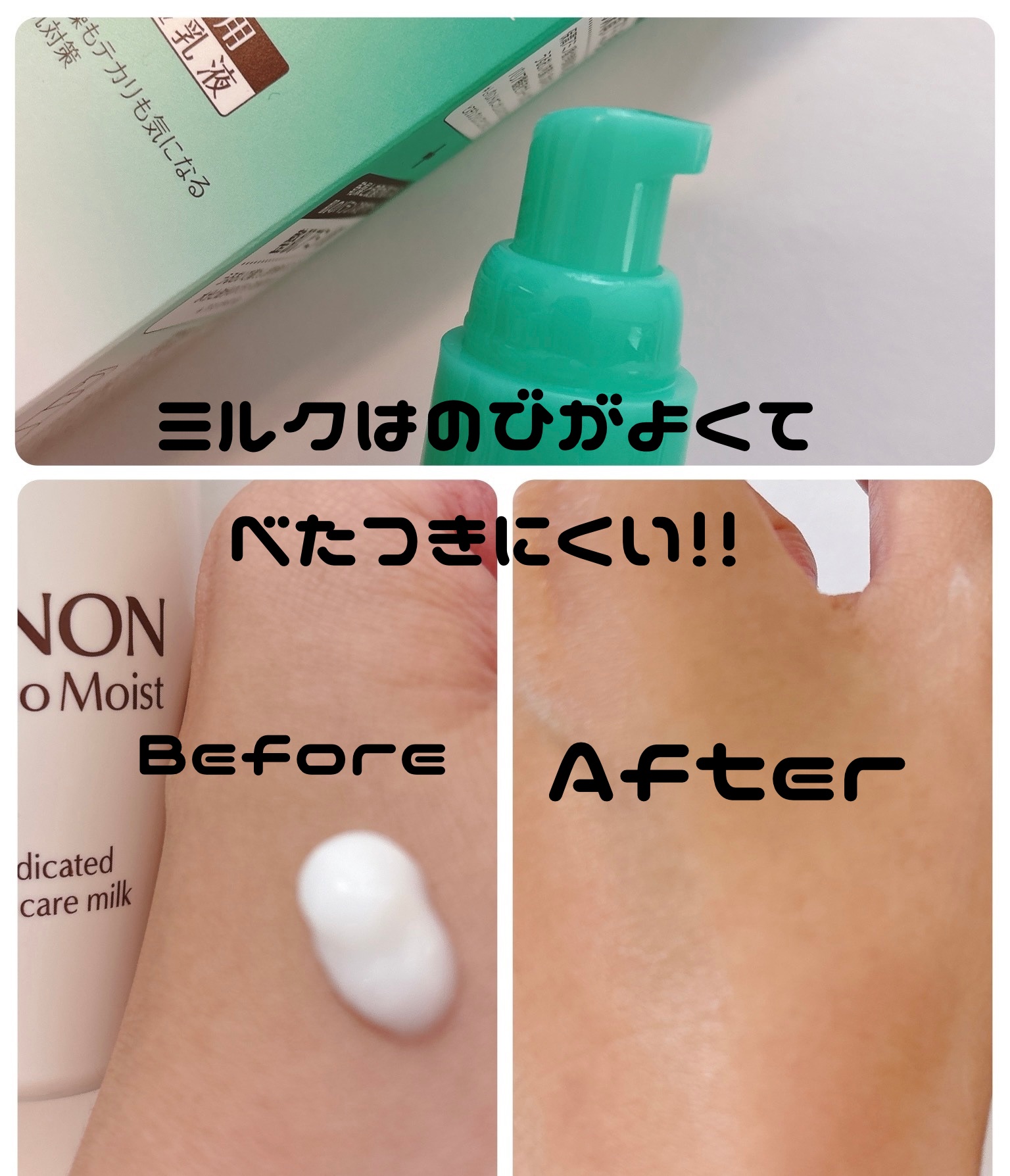 ミノン アミノモイスト 薬用アクネケア ローション/ミノン/化粧水を使ったクチコミ（3枚目）