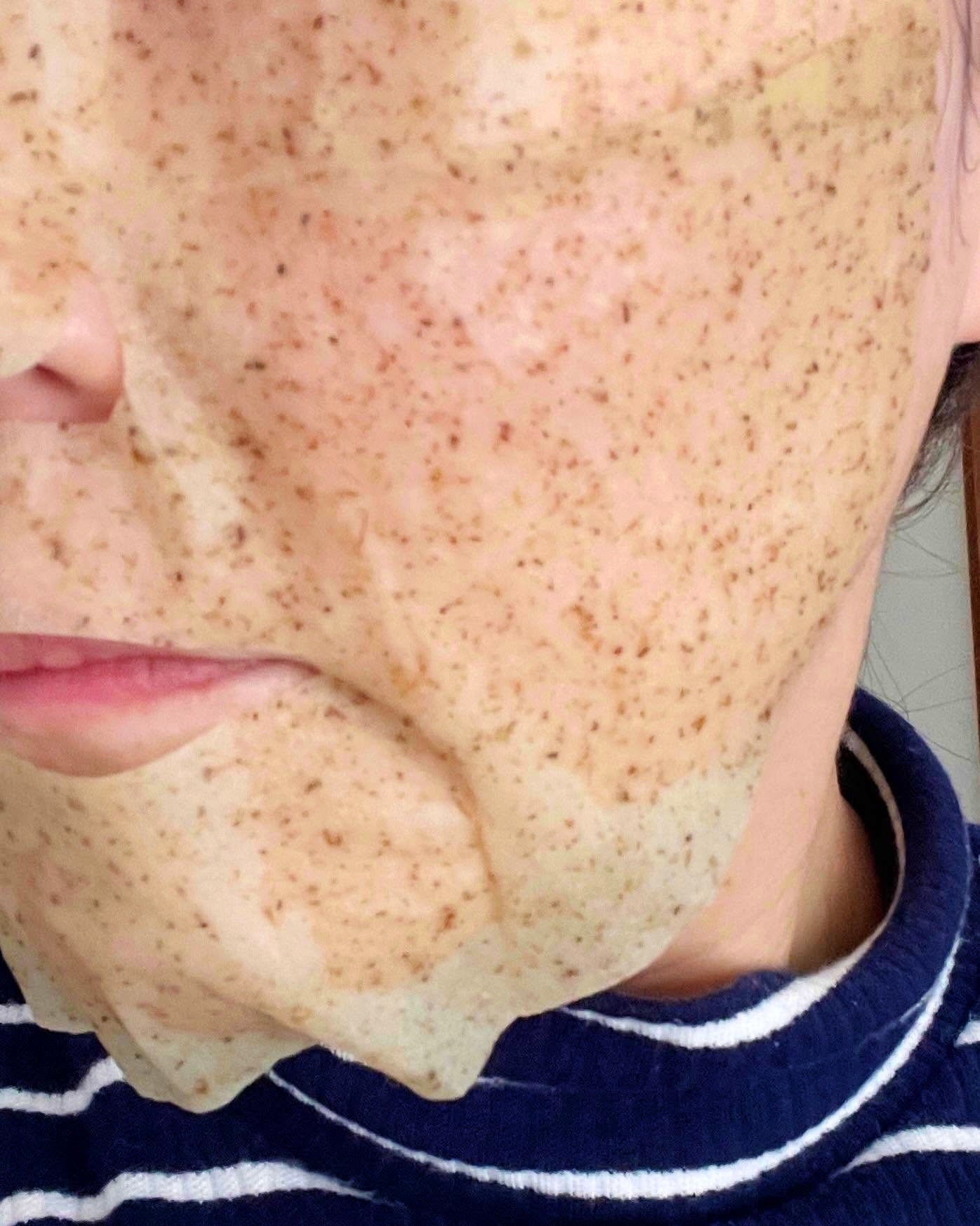 ツボクサスージングハイドロヨモギマスク/LIALUSTER/シートマスク・パックを使ったクチコミ(7枚目)