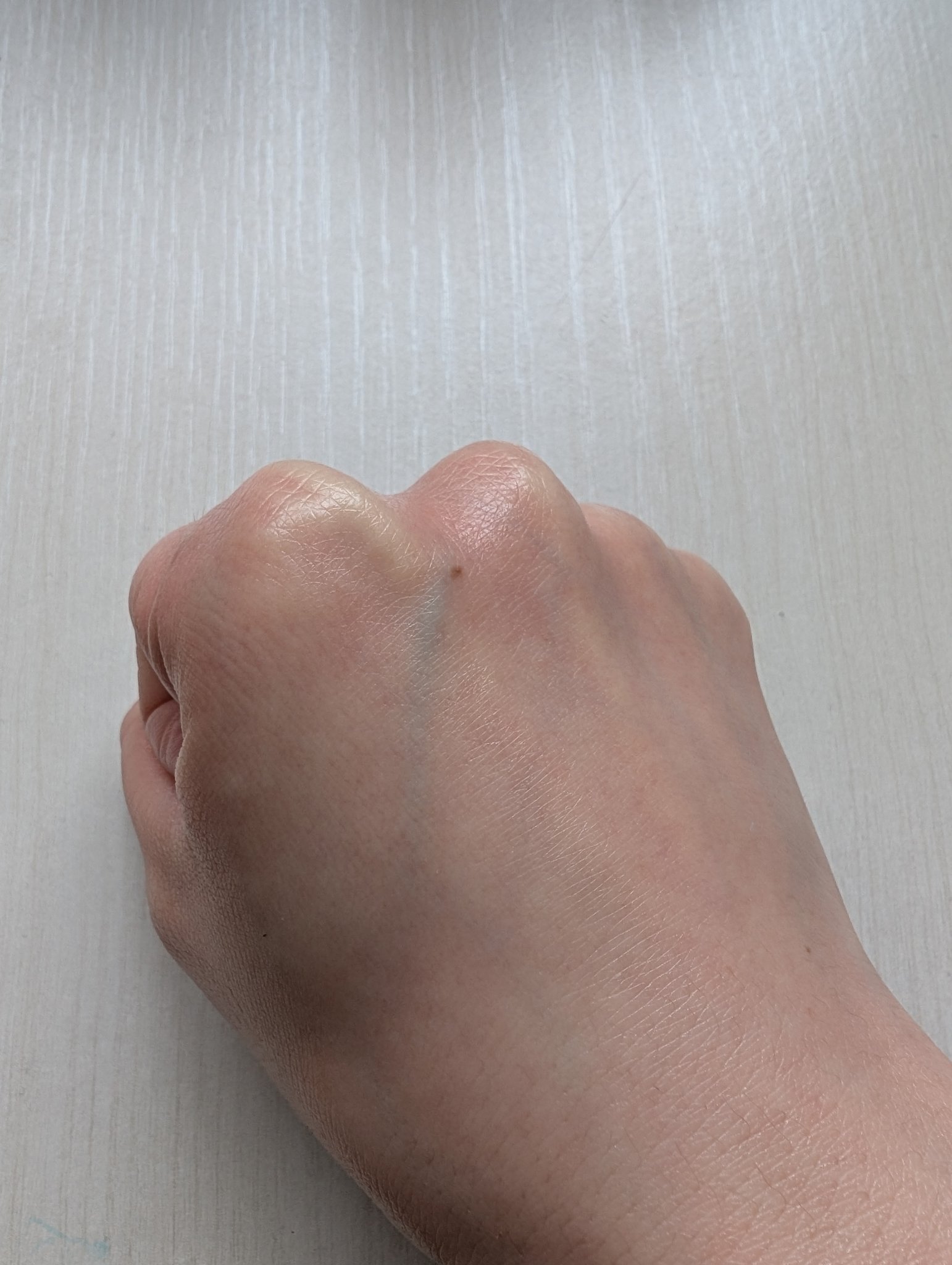 プロバイオシカ インテンシブ アンプル/SKIN1004/美容液を使ったクチコミ（3枚目）