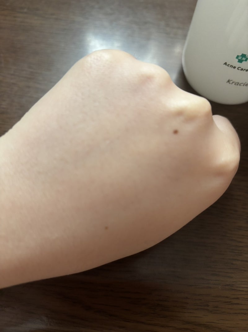 肌美精 CHOI薬用化粧水 ニキビケア[医薬部外品]/肌美精/化粧水を使ったクチコミ（3枚目）