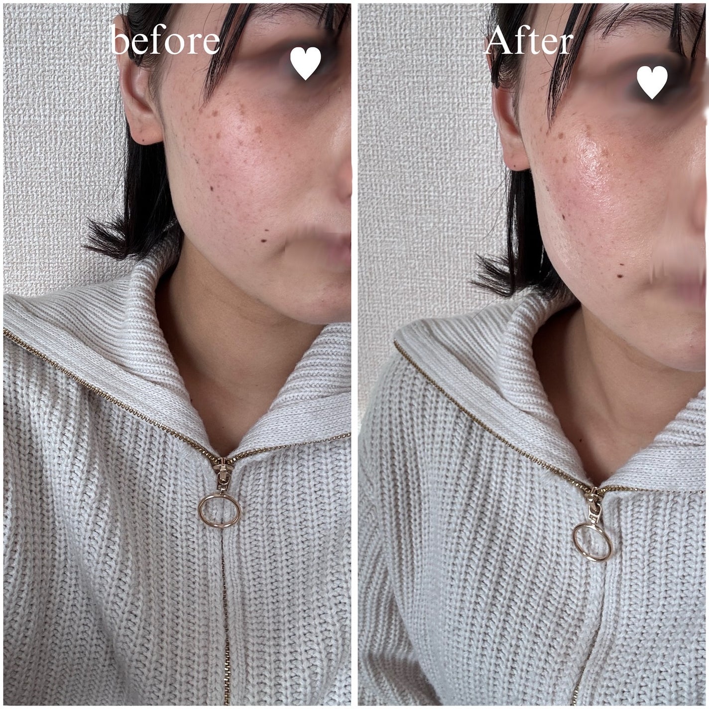 ビタコラーゲン ブライトニング トナーパッド/ダーマフィックス/トナーパッドを使ったクチコミ(3枚目)