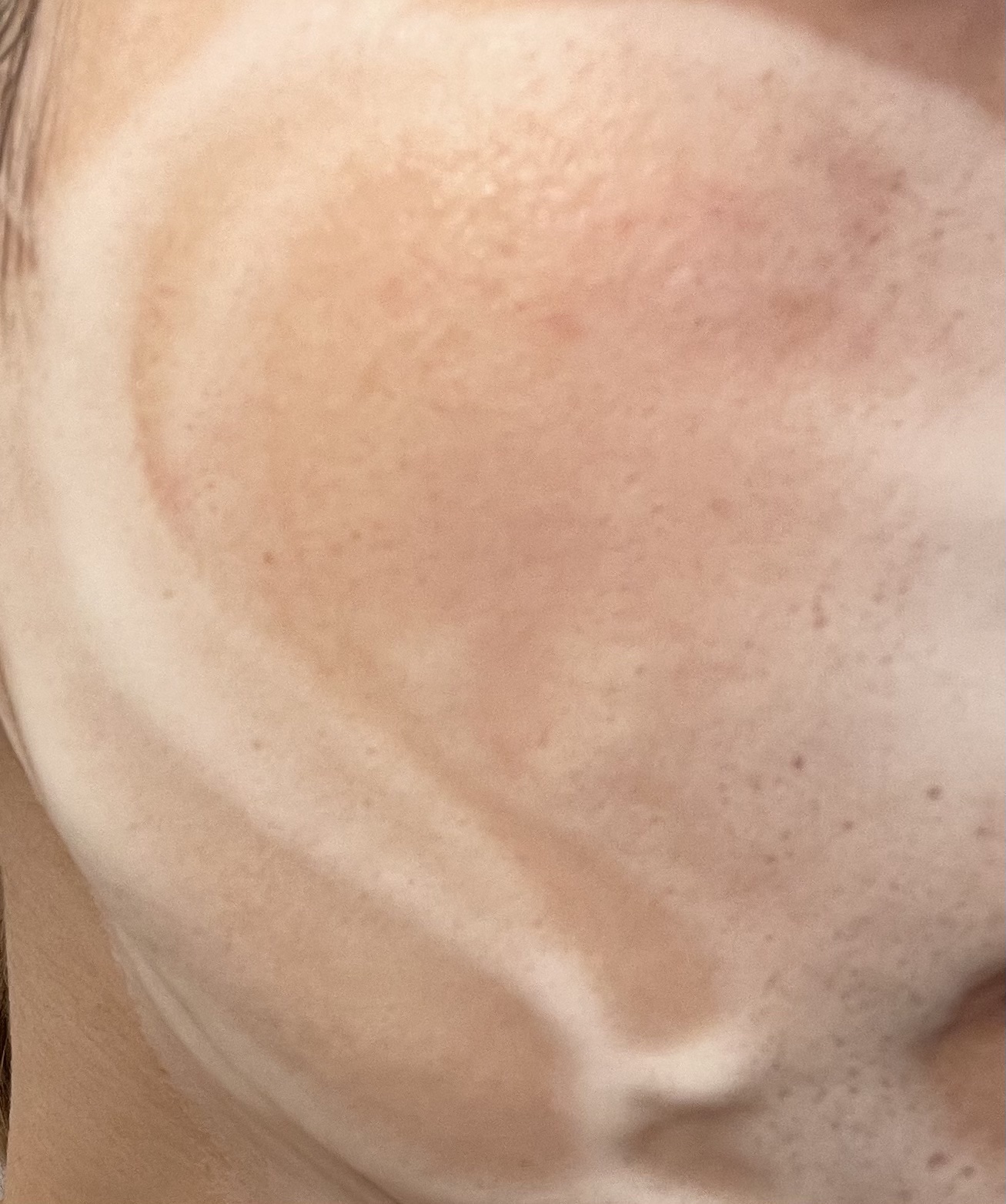 モイスチュア ウォッシングフォーム/カルテHD/泡洗顔を使ったクチコミ（3枚目）