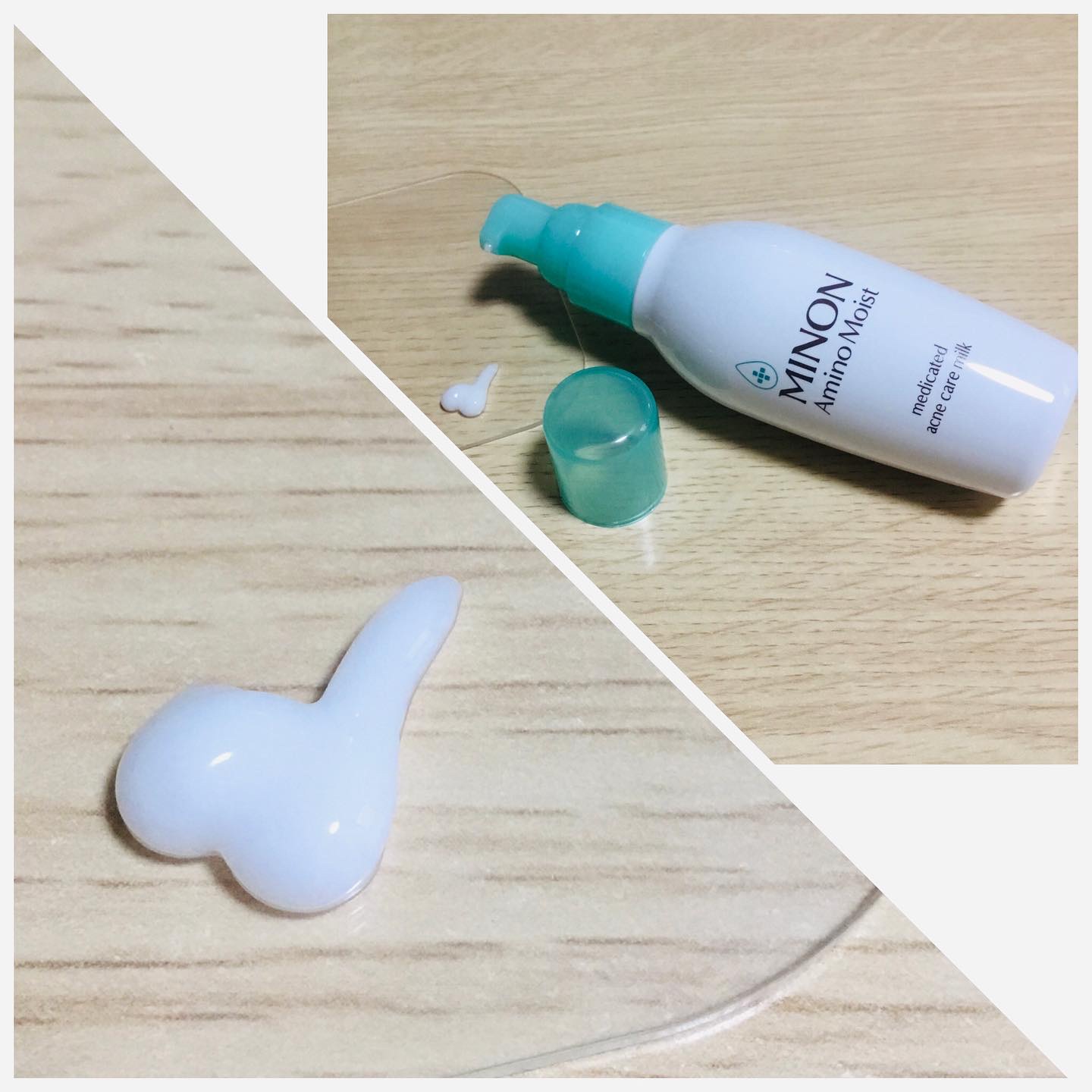 ミノン アミノモイスト 薬用アクネケア ローション/ミノン/化粧水を使ったクチコミ（3枚目）