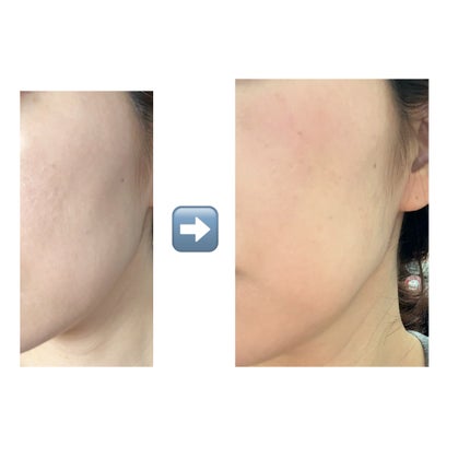 ネーミング ソフティクリームブラッシュ/NAMING./ジェル・クリームチークを使ったクチコミ(4枚目)