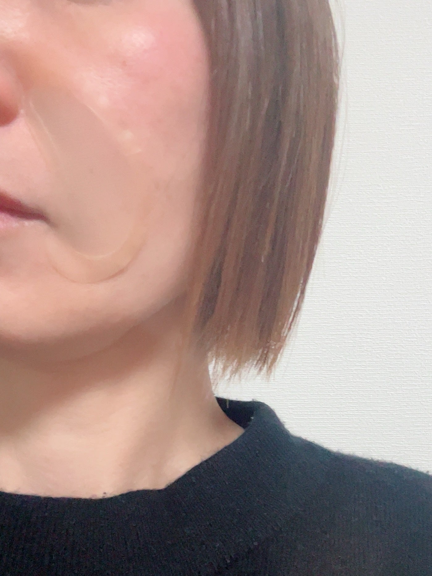 アイバックリフト1100シャットリードルパッチ/CHARDE/シートマスク・パックを使ったクチコミ(6枚目)