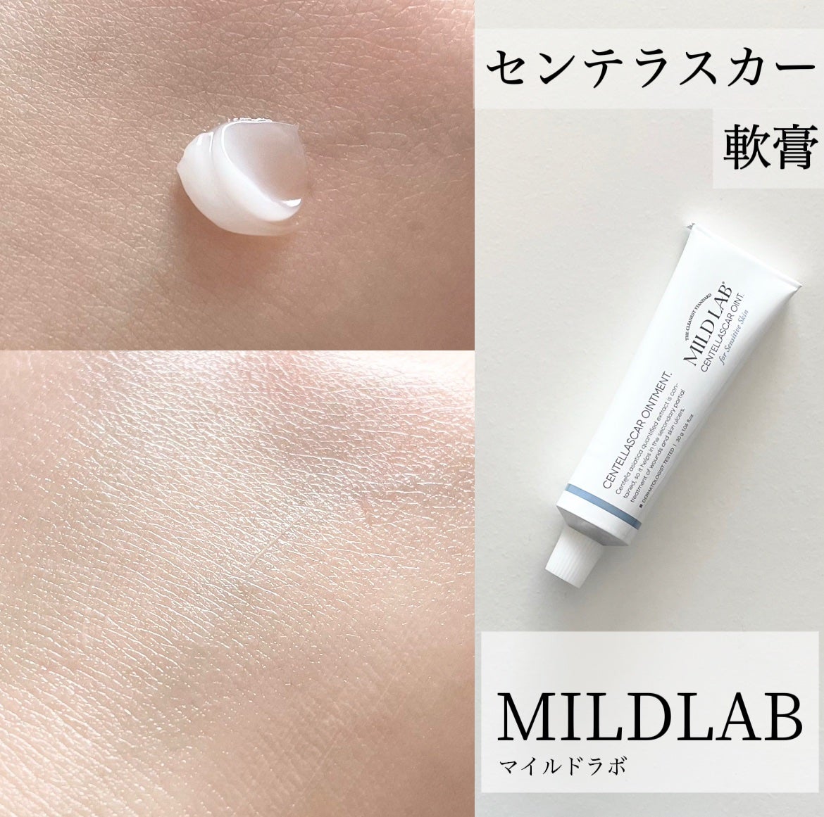 センテラスカー 軟膏 (オイントメント)/Mildlab/フェイスクリームを使ったクチコミ(1枚目)