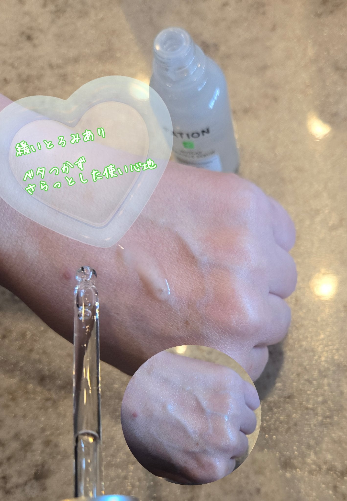 ノスカナイン トラブル セラム/FATION/美容液を使ったクチコミ(2枚目)