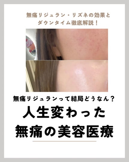 ã䜿ã£ãã¯ãã³ãïŒ1æç®ïŒ