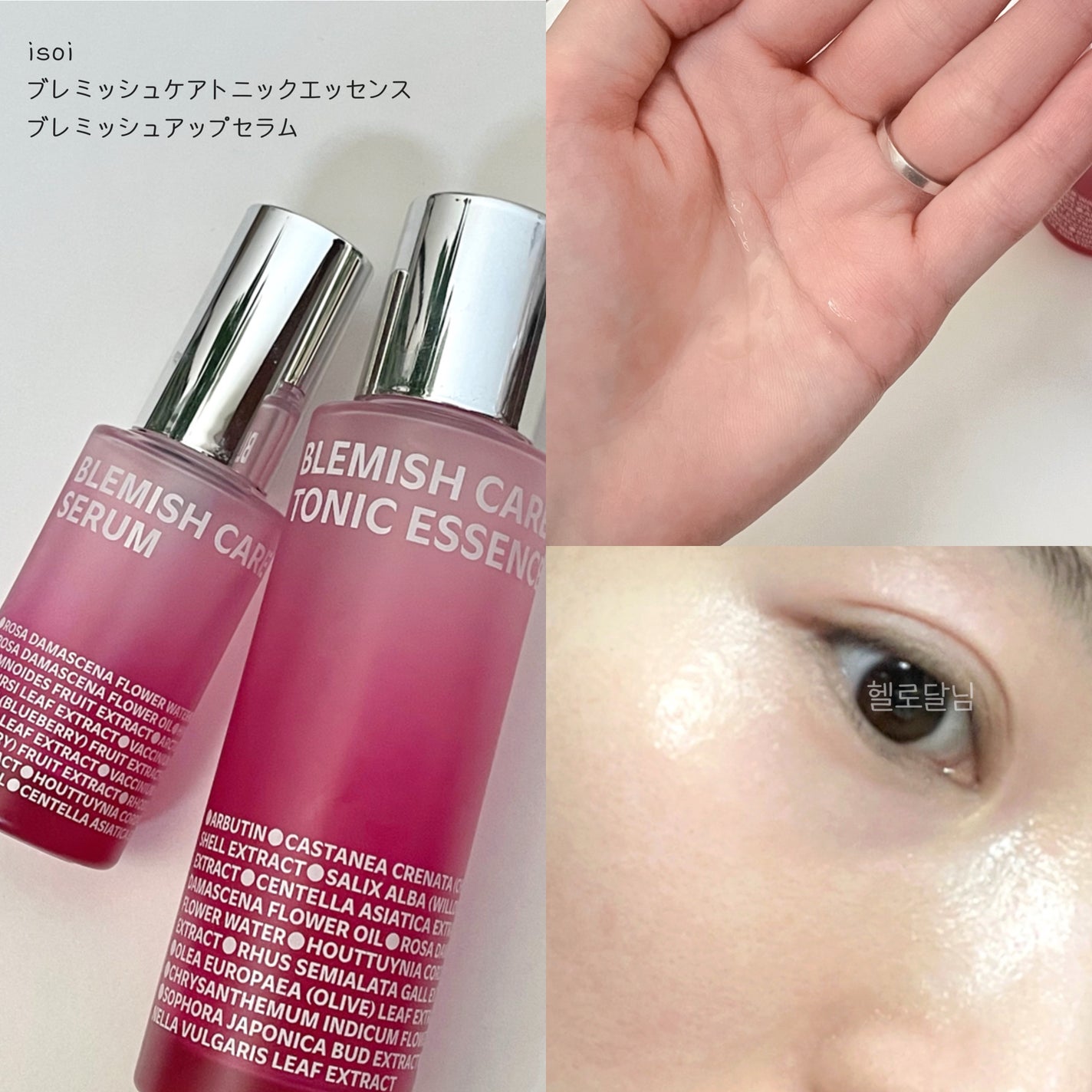 ブレミッシュケア トニックエッセンス/ISOI/化粧水を使ったクチコミ(1枚目)