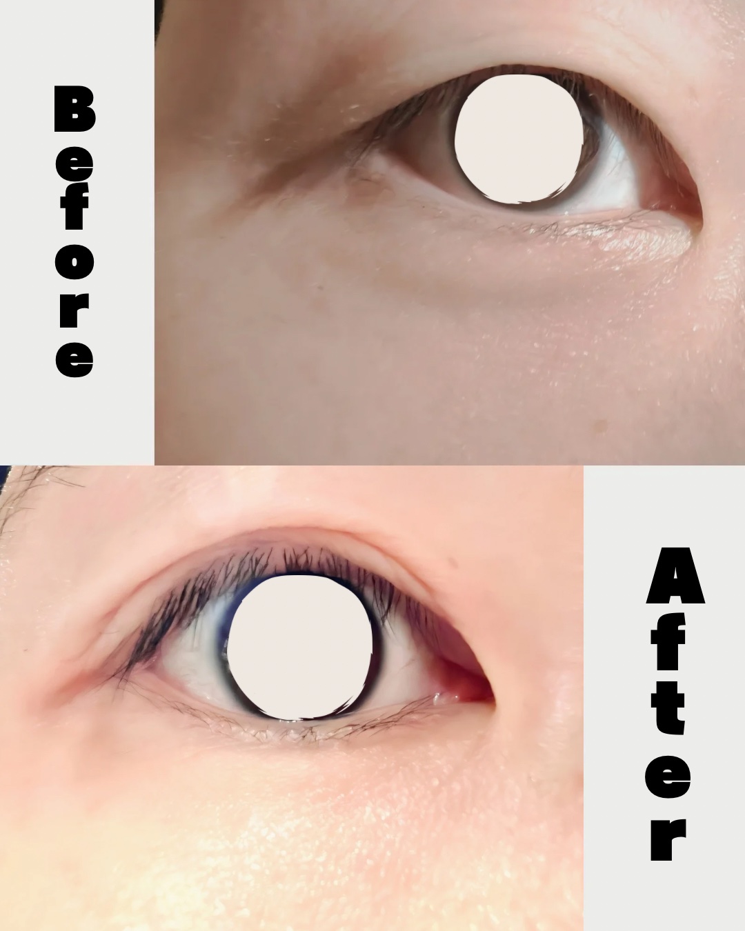 メザイク クリップ カッター ファイバー専用カッター/メザイク/二重まぶた用アイテムを使ったクチコミ（2枚目）