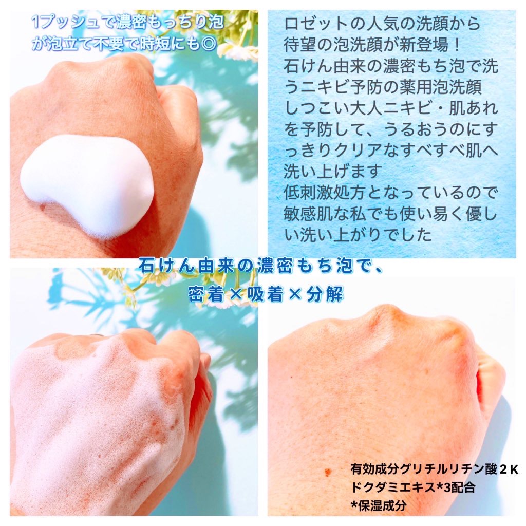 ロゼット洗顔サボン アクネウォッシュ【医薬部外品】[泡洗顔料]/ロゼット/泡洗顔を使ったクチコミ（2枚目）