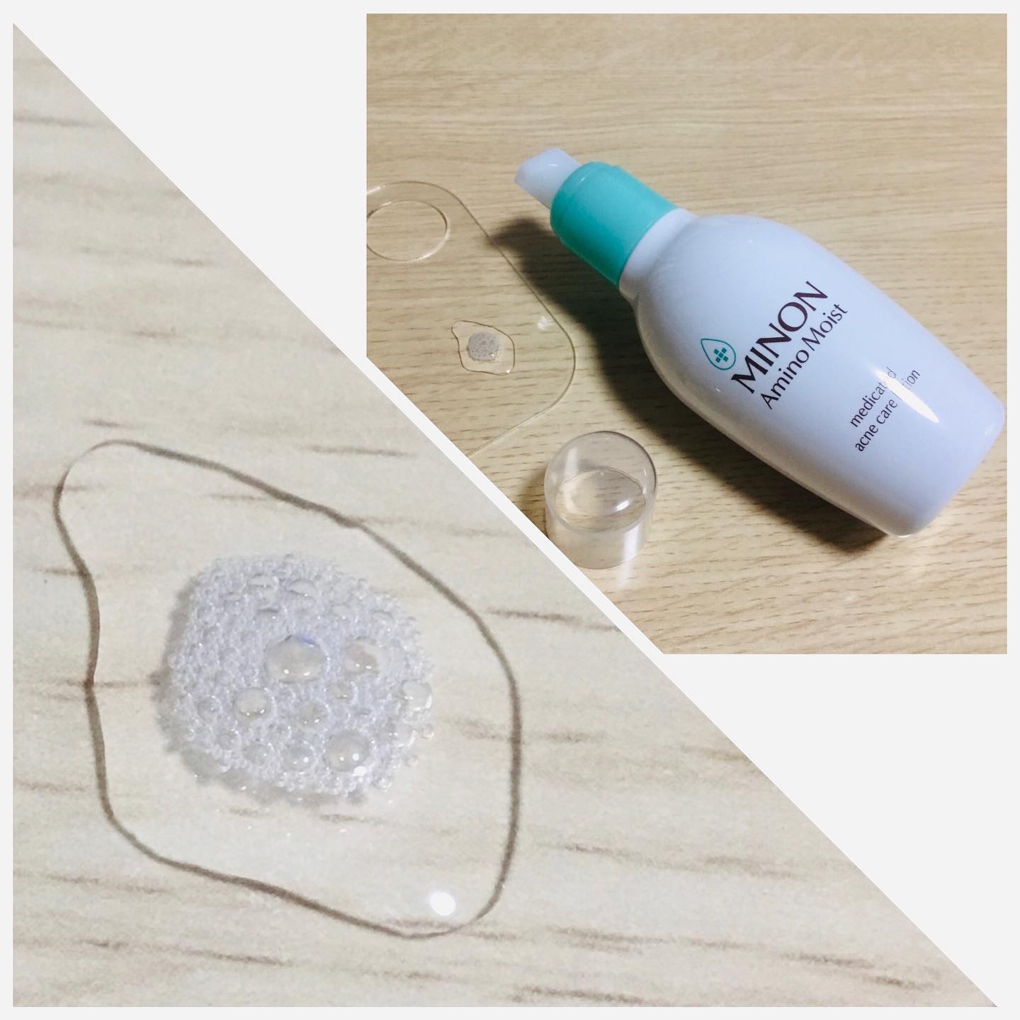 ミノン アミノモイスト 薬用アクネケア ローション/ミノン/化粧水を使ったクチコミ（2枚目）