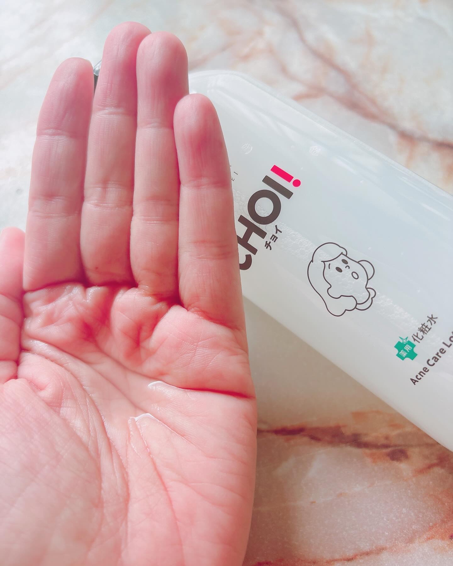 肌美精 CHOI薬用化粧水 ニキビケア[医薬部外品]/肌美精/化粧水を使ったクチコミ（2枚目）