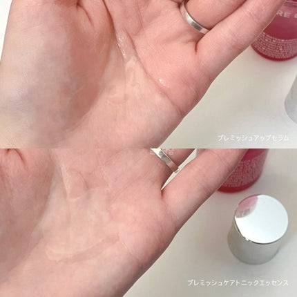 ブレミッシュケア トニックエッセンス/ISOI/化粧水を使ったクチコミ(2枚目)