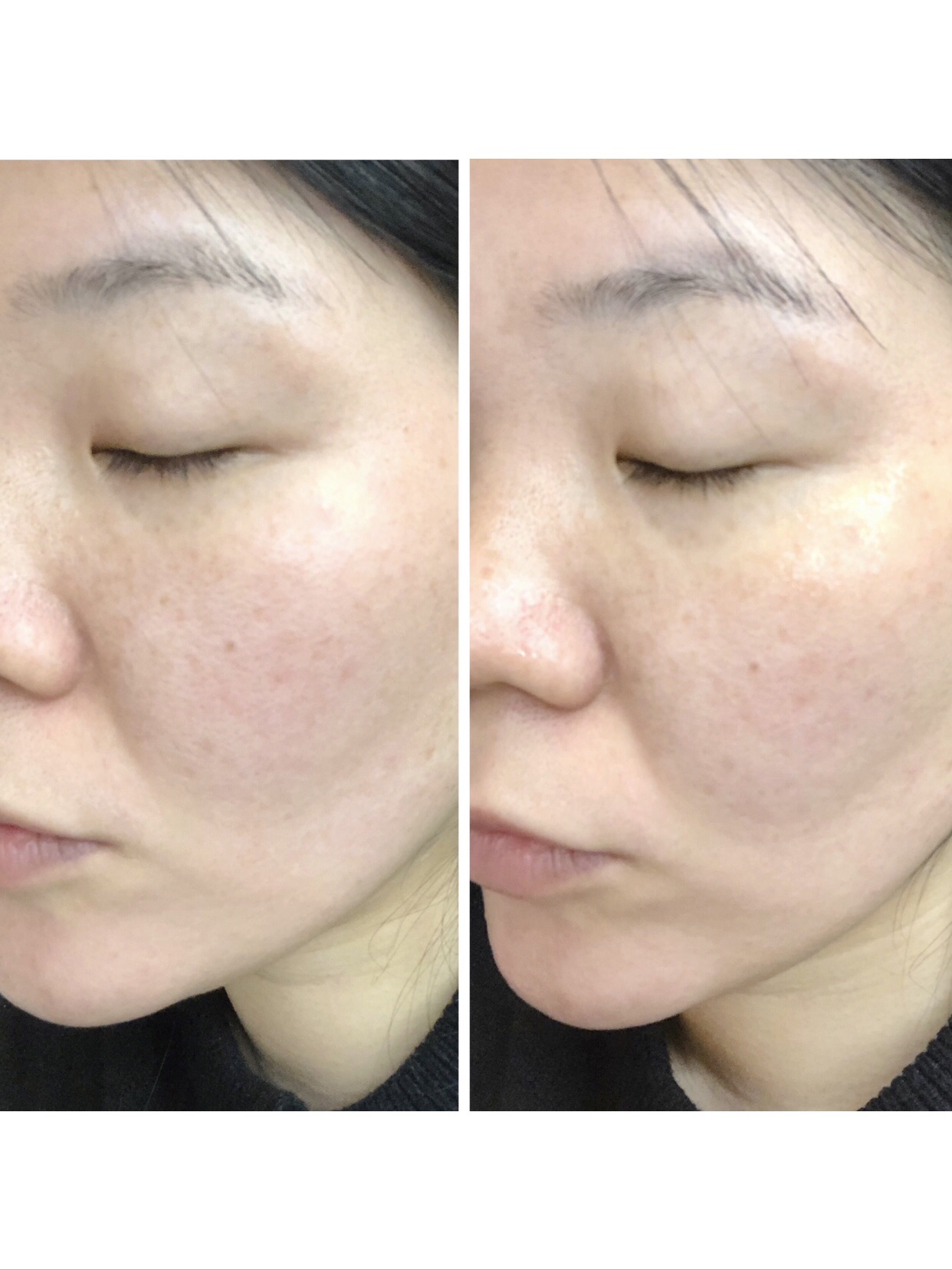 センテラ クイックカーミングパッド/SKIN1004/トナーパッドを使ったクチコミ（3枚目）