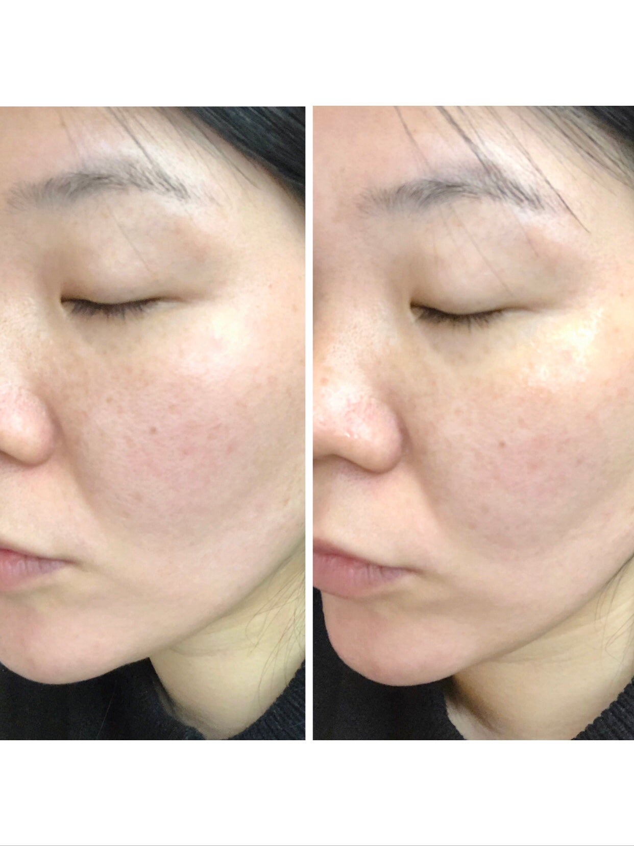 センテラ クイックカーミングパッド/SKIN1004/トナーパッドを使ったクチコミ(3枚目)