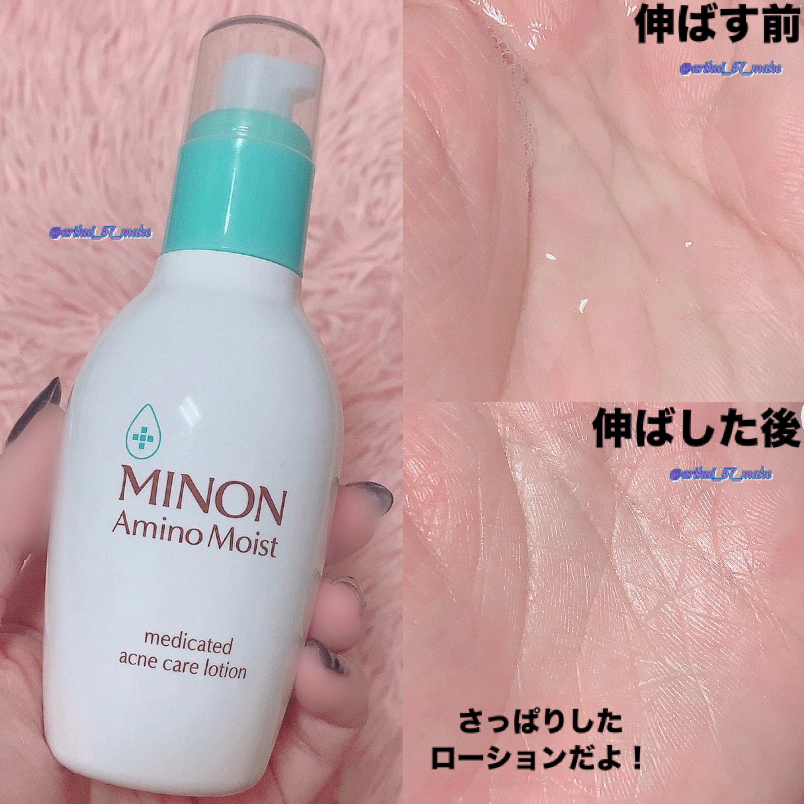 ミノン アミノモイスト 薬用アクネケア ローション/ミノン/化粧水を使ったクチコミ（3枚目）