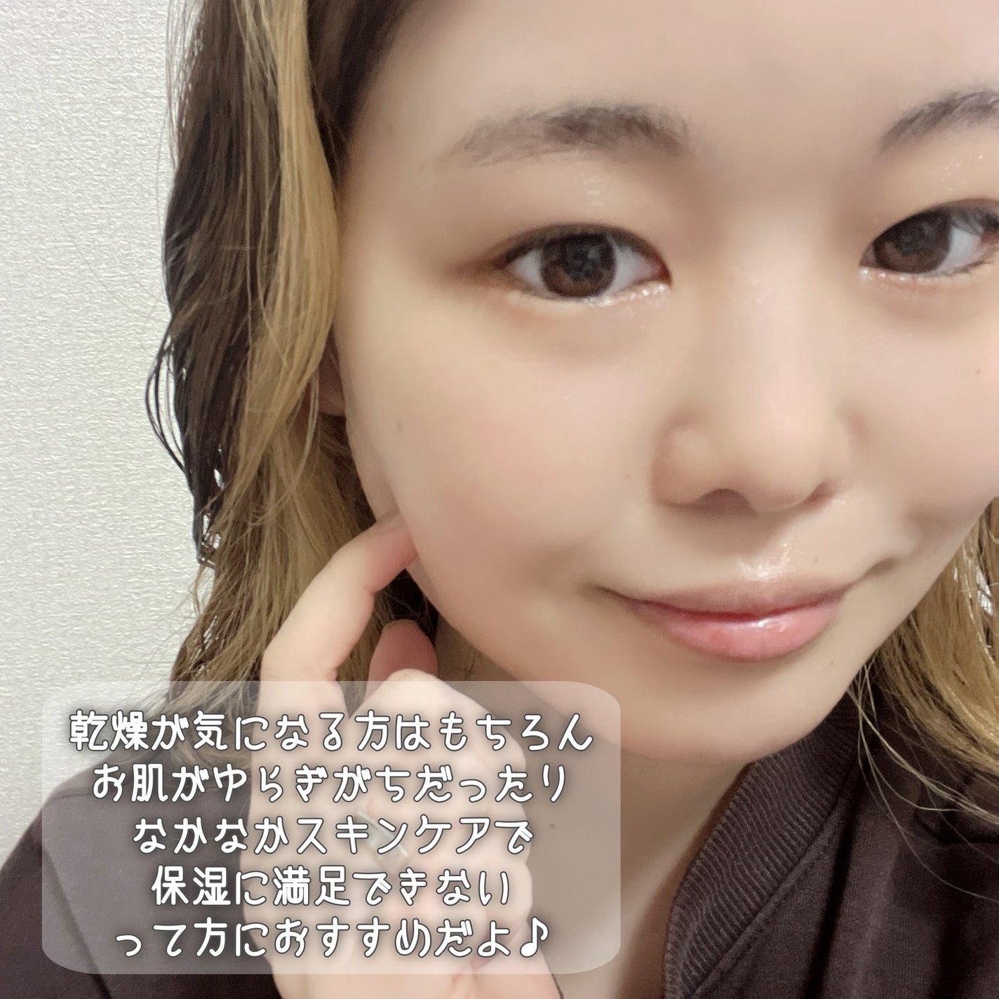 モイスチュア ローション/カルテHD/化粧水を使ったクチコミ(5枚目)