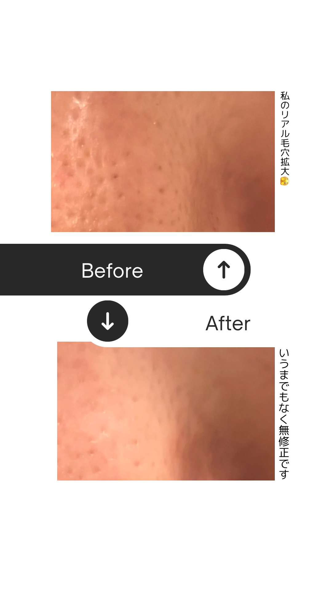 レッドブースター リードルショット100/VT/ブースター・導入液を使ったクチコミ（3枚目）