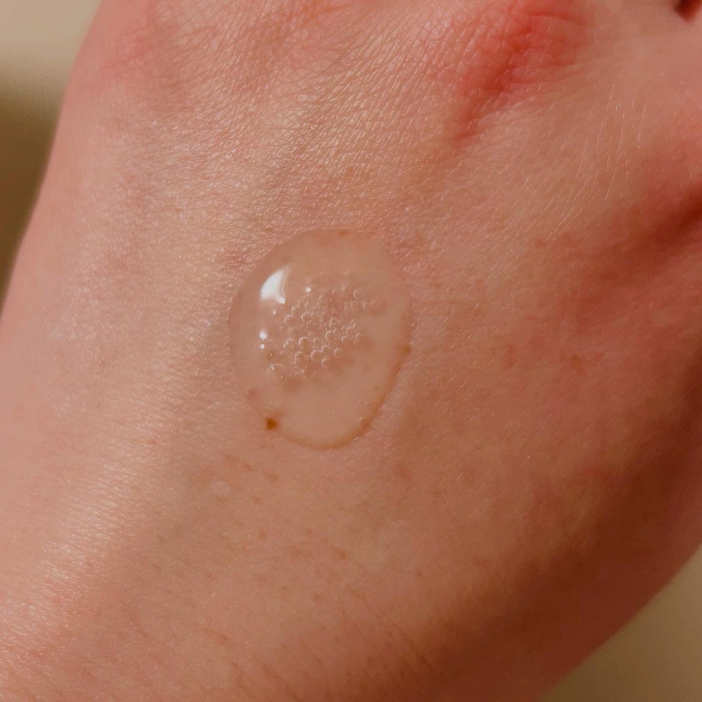 ナチュラルアクアジェル/Cure/ピーリングを使ったクチコミ(3枚目)