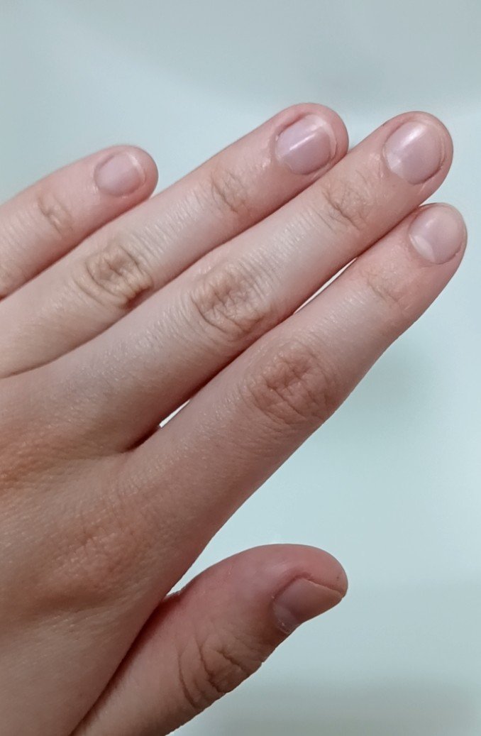 アロマキューティクルオイル/D-UP/ネイルオイル・トリートメントを使ったクチコミ（1枚目）