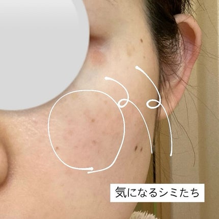 kikið€ãã©ãã100ðŒ on LIPS ãã·ãæ¶ããããã£ãŠã¿ãïŒANS.ã®ãªã³ã©ã€ã³èæ²»çã§ç
é¢ã«è¡ã..ãïŒ8æç®ïŒ