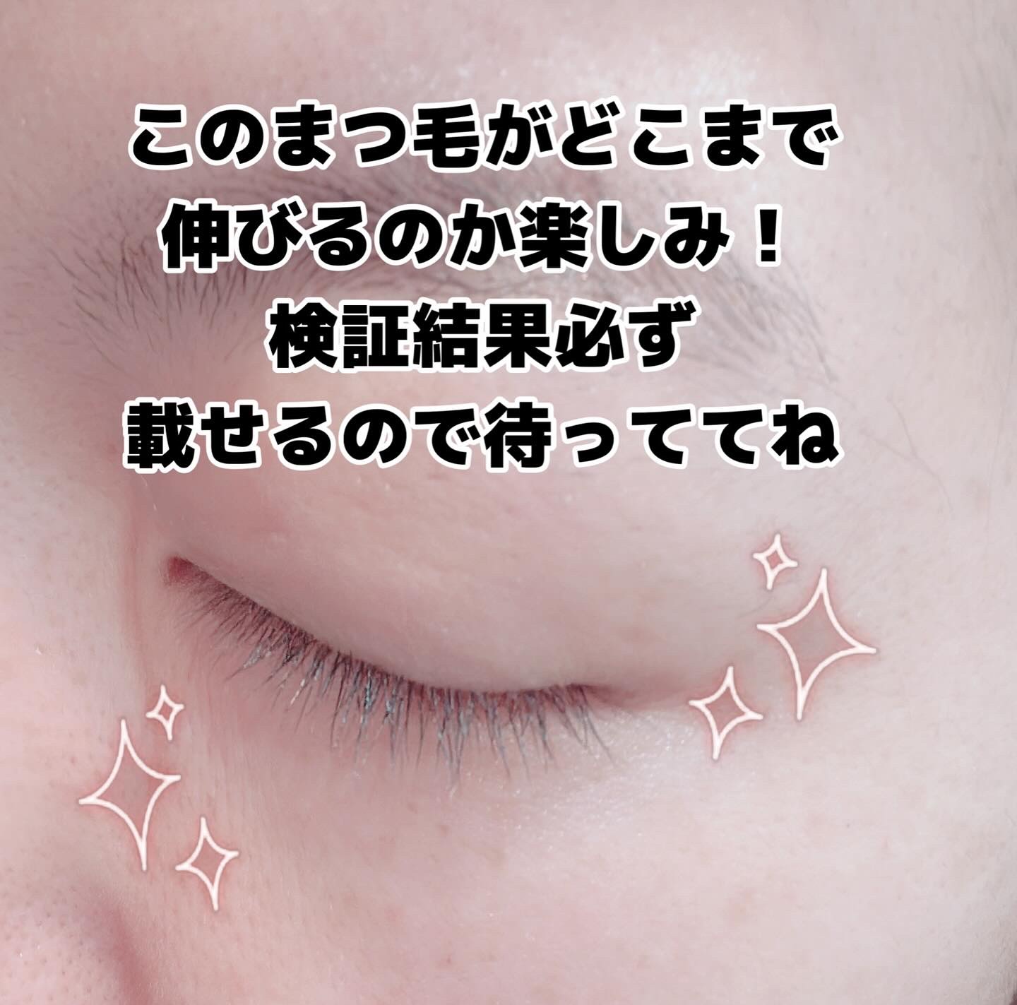 アイラッシュエッセンシャルセラム/epais/まつげ美容液を使ったクチコミ（2枚目）