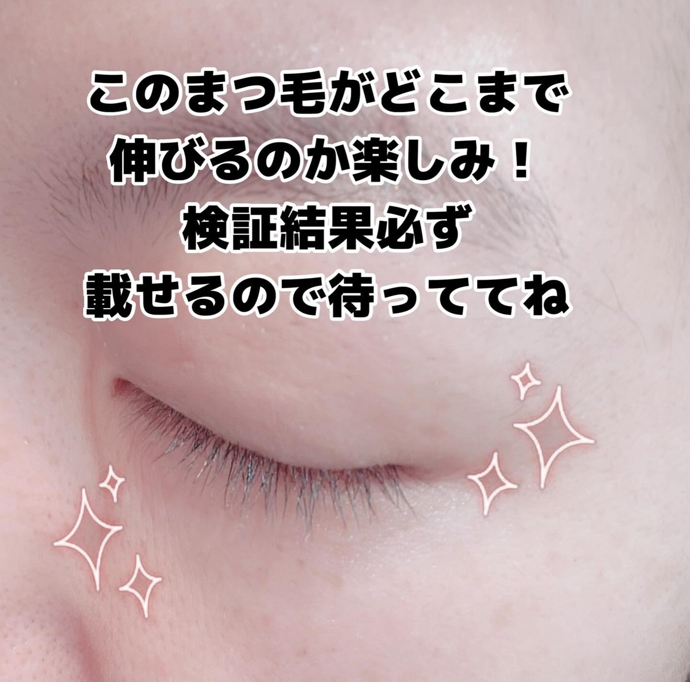 アイラッシュエッセンシャルセラム/epais/まつげ美容液を使ったクチコミ(2枚目)