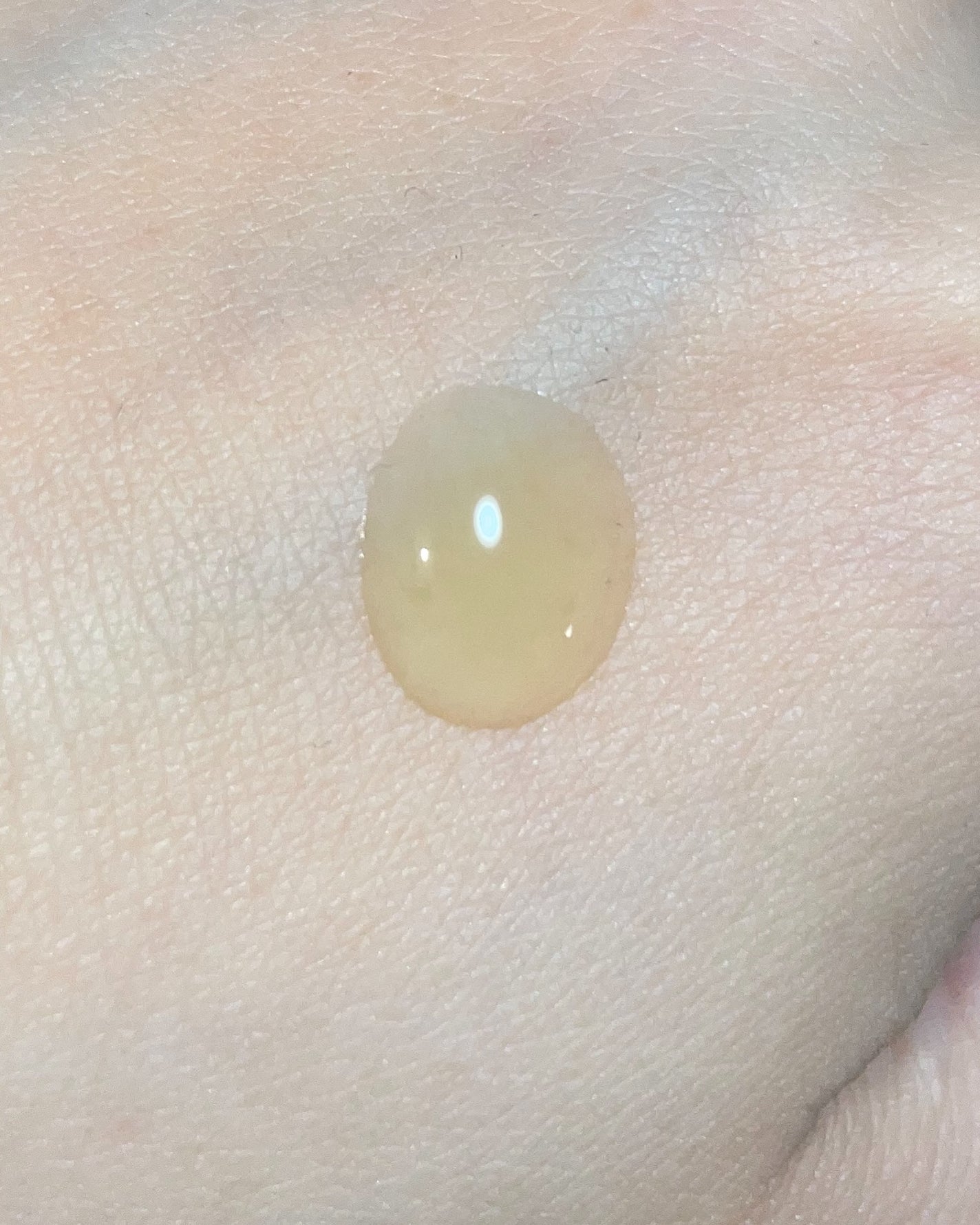 GlutanaC Brightening IV/Dr.ROSA/美容液を使ったクチコミ(6枚目)