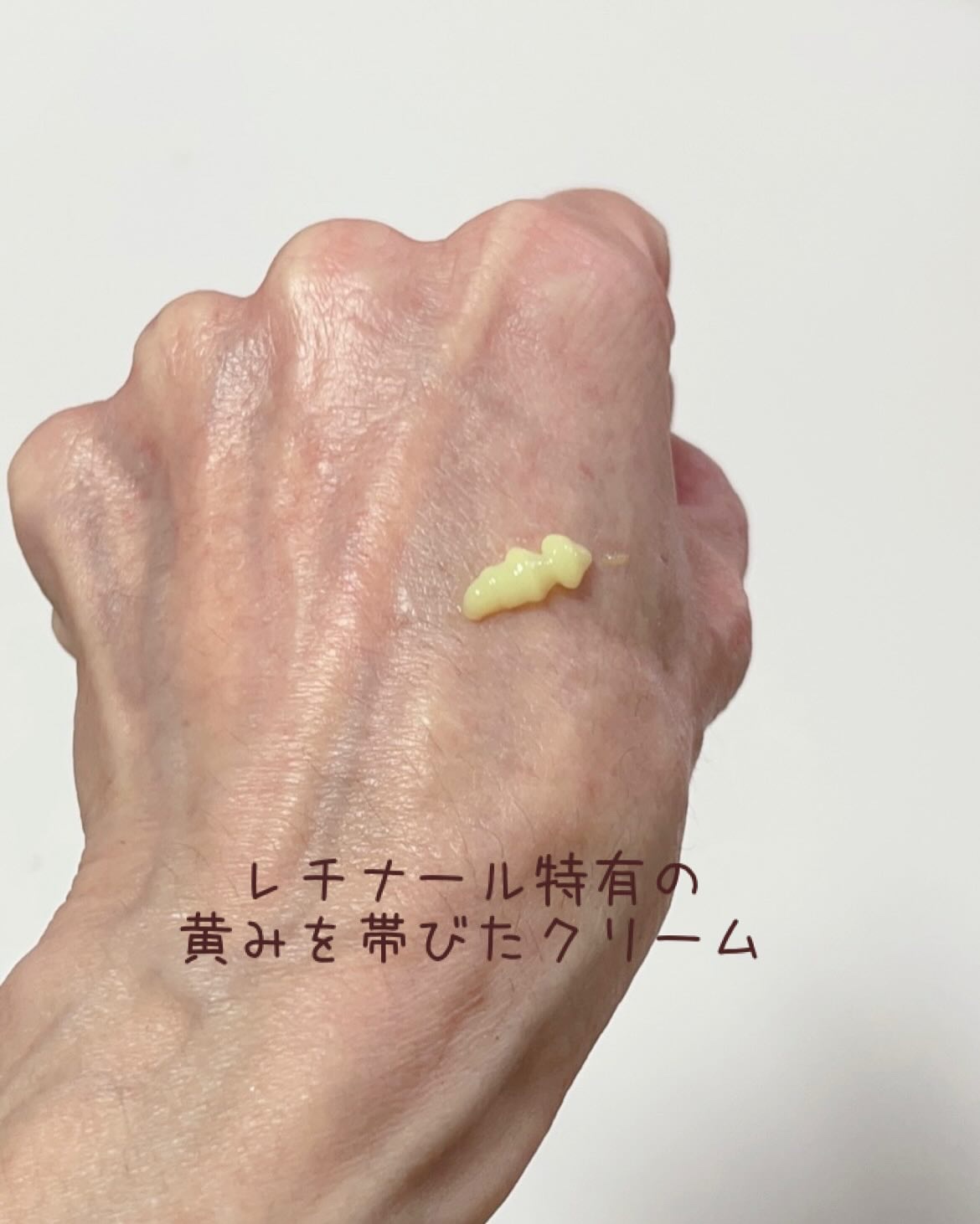 VITALIFT A forte/Dr.Different/フェイスクリームを使ったクチコミ（3枚目）