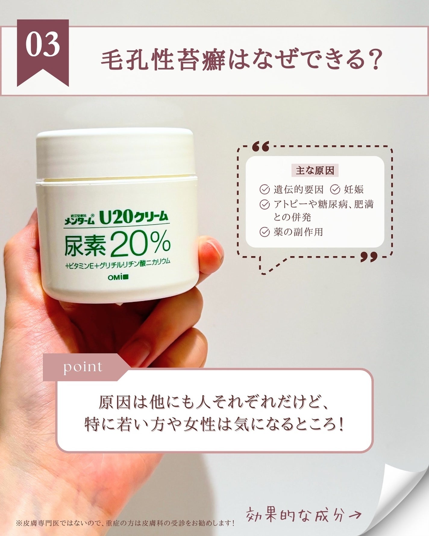 U20クリーム(医薬品)/メンターム/その他を使ったクチコミ(4枚目)