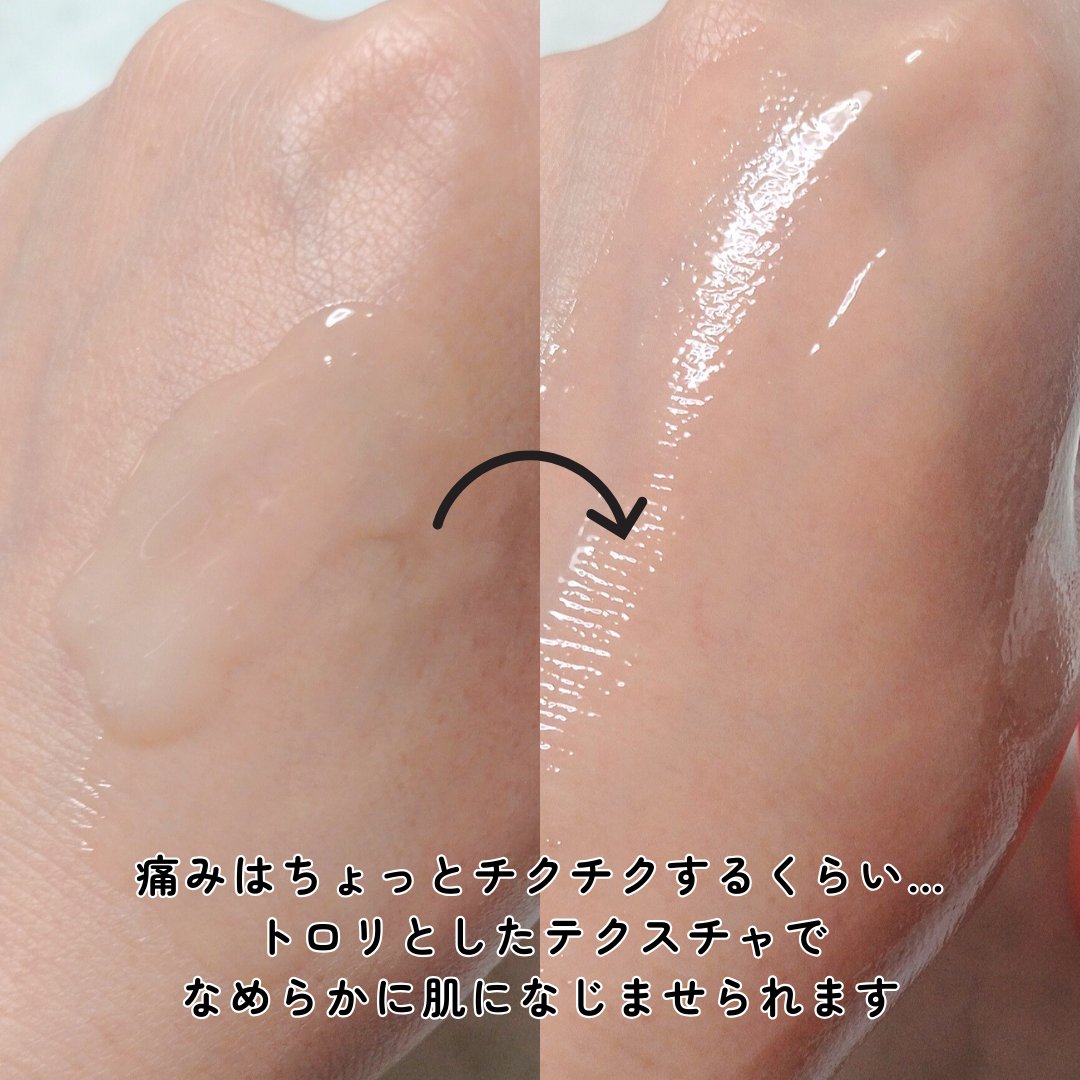 PDRNショット675/COSNORI/美容液を使ったクチコミ（3枚目）