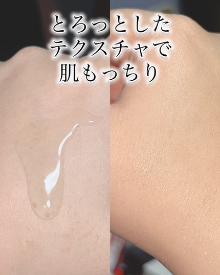 REJURAN デュアルエフェクトアンプル 30ml/REJURAN COSMETICS/美容液を使ったクチコミ(4枚目)