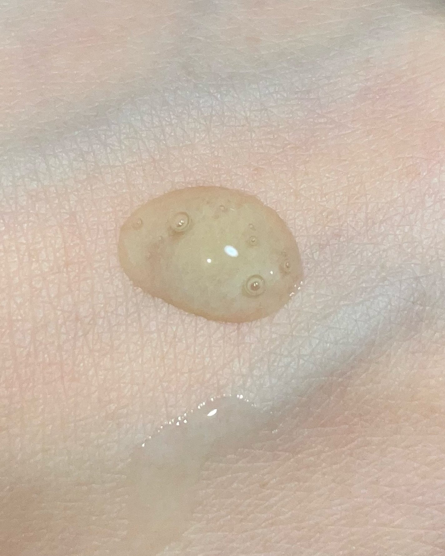 GlutanaC Brightening IV/Dr.ROSA/美容液を使ったクチコミ(4枚目)