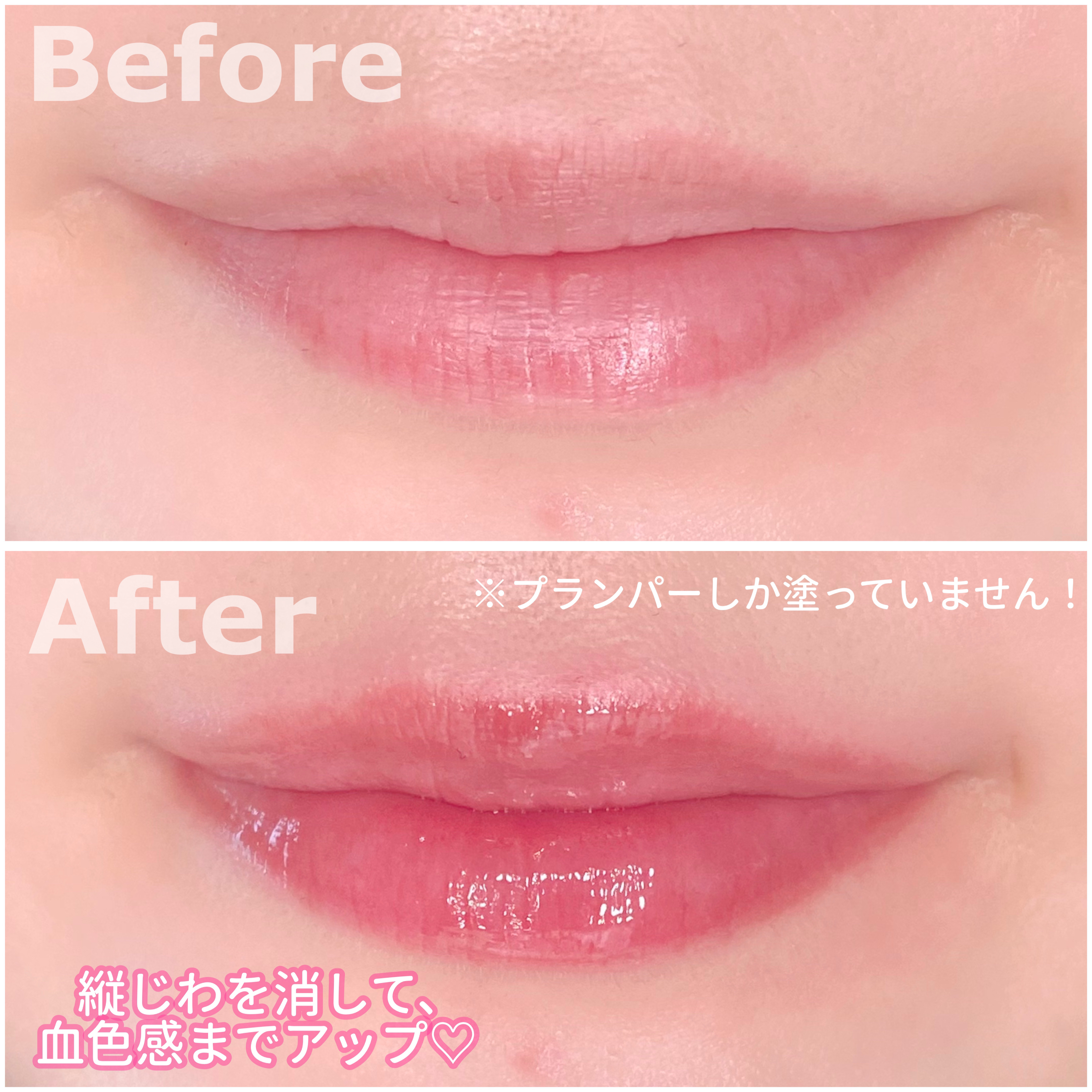 ボリュームリッププランパー/BANILA CO/リッププランパーを使ったクチコミ（2枚目）