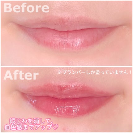 ボリュームリッププランパー/BANILA CO/リッププランパーを使ったクチコミ(2枚目)