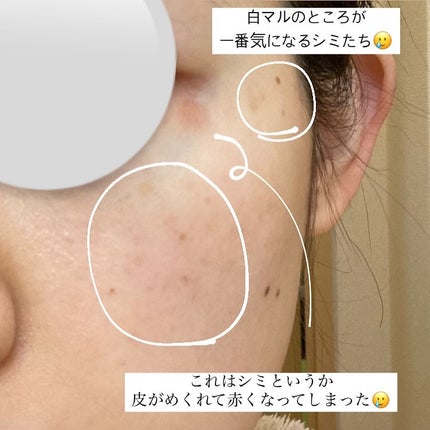 を使ったクチコミ(2枚目)