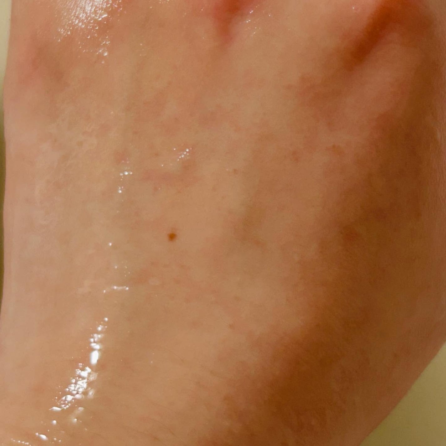 ナチュラルアクアジェル/Cure/ピーリングを使ったクチコミ(4枚目)