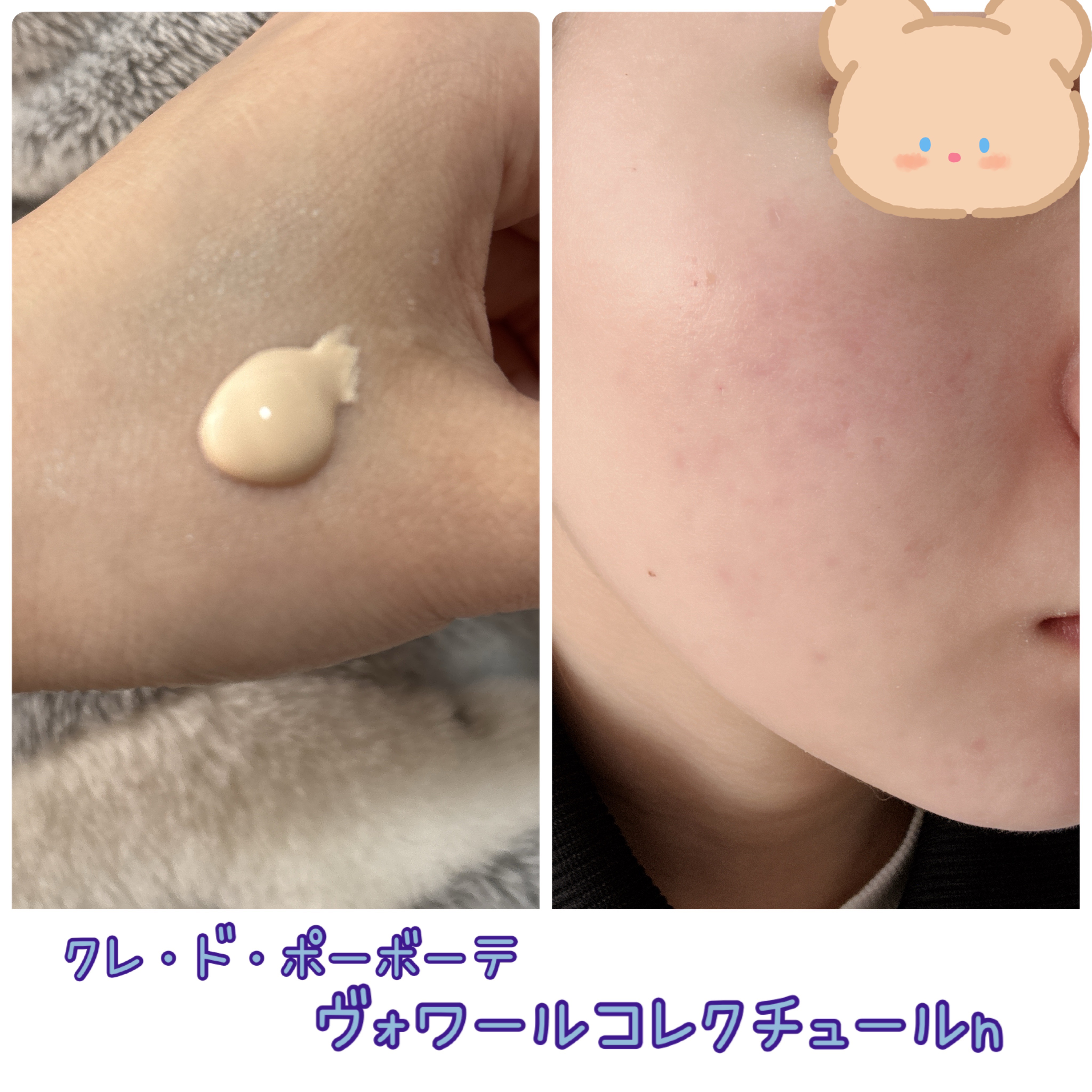 ディオールスキン フォーエヴァー フルイド グロウ/Dior/リキッドファンデーションを使ったクチコミ（2枚目）