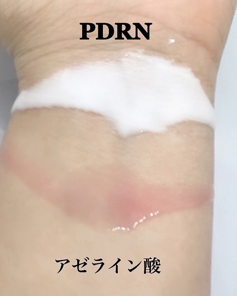 シカレチA エッセンス0.1/VT/美容液を使ったクチコミ（3枚目）