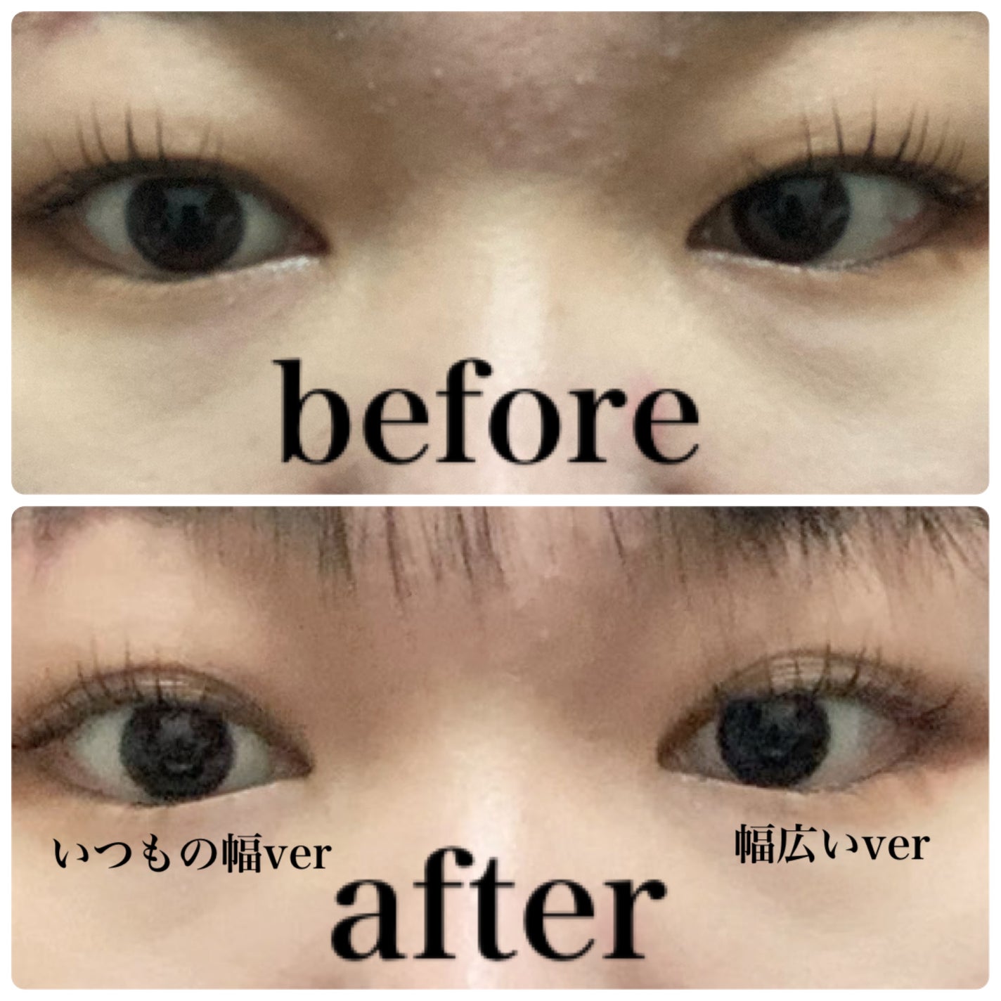 メザイク クリップ カッター ファイバー専用カッター/メザイク/二重まぶた用アイテムを使ったクチコミ(6枚目)