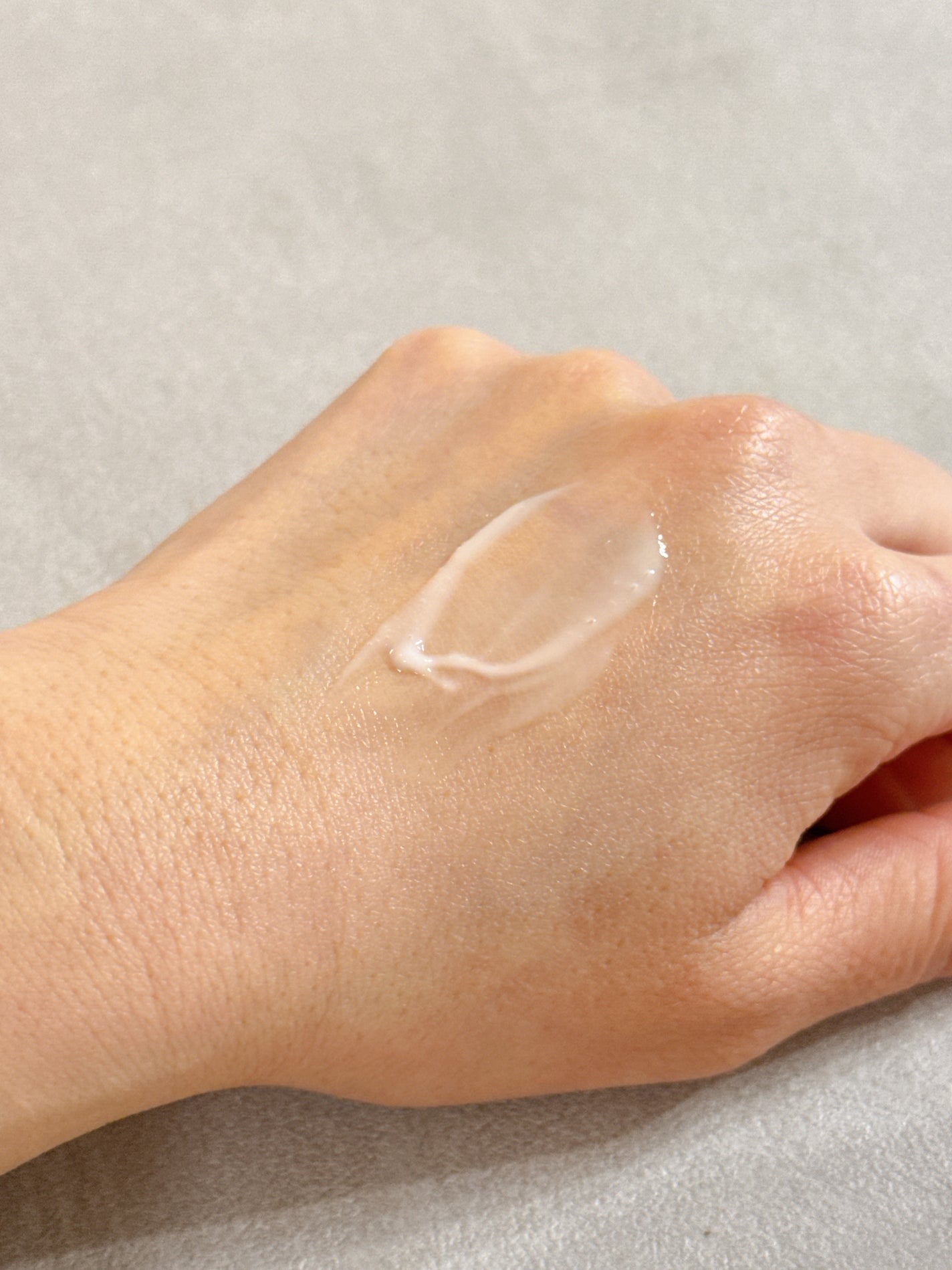 ミノン アミノモイスト 薬用アクネケア ローション/ミノン/化粧水を使ったクチコミ(3枚目)