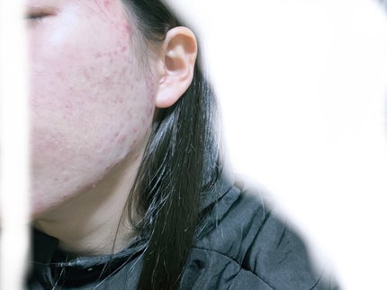 ビーベルベットカバークッション/espoir/クッションファンデーションを使ったクチコミ(4枚目)