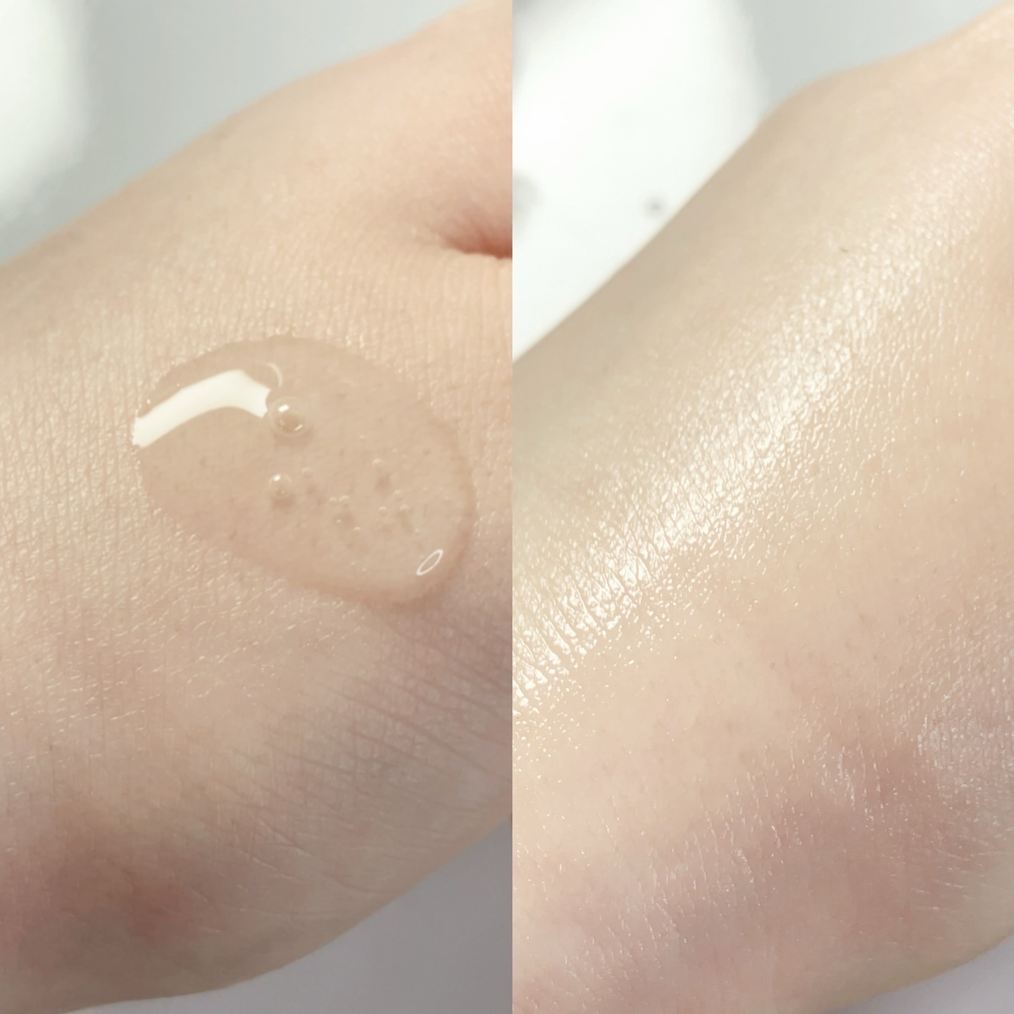 ノスカナイン トラブル セラム/FATION/美容液を使ったクチコミ（3枚目）